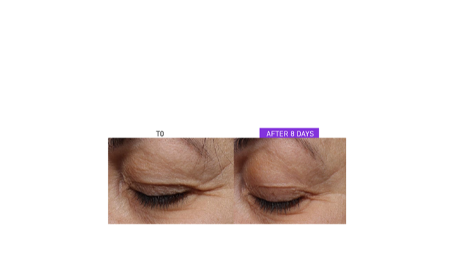 DF18+ Skingenius Eye contour